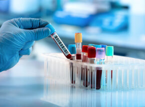 Medical Test